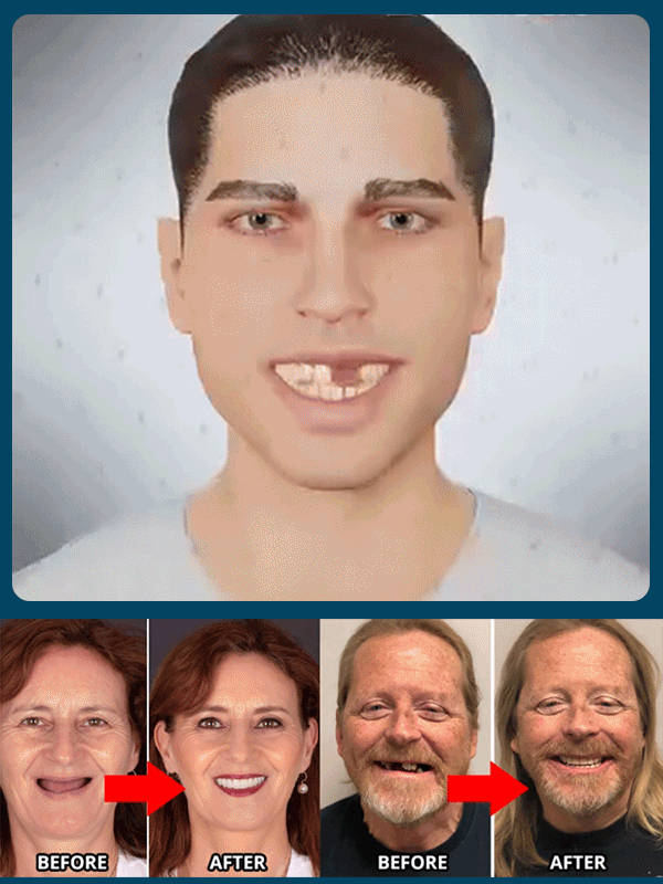 Upgraded upper and lower denture with gum line—gum-line version for ultra-invisibility!✅ Installs in 1 second, comfortable and secure for 48 hours!