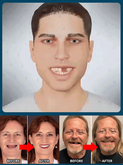 Upgraded upper and lower denture with gum line—gum-line version for ultra-invisibility!✅ Installs in 1 second, comfortable and secure for 48 hours!